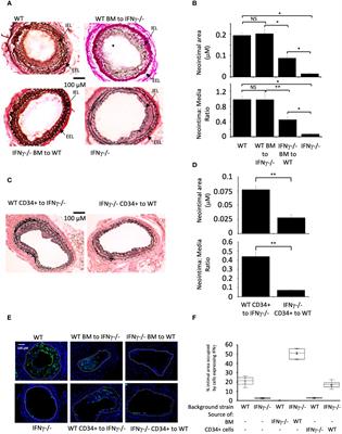 Neointimal hyperplasia after endoluminal injury in mice is dependent on tissue factor- and angiopoietin-2 dependent interferon gamma production by fibrocytes and macrophages